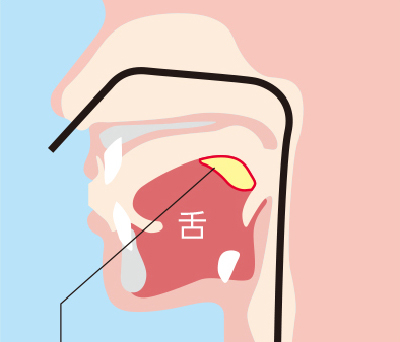 経鼻内視鏡検査